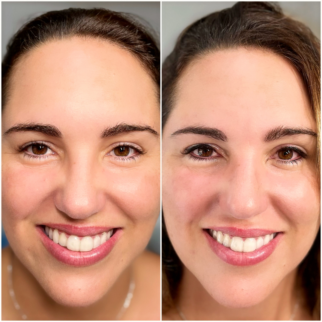 Close image of the result of a micropigmentation work by Deluxe Micropigmentation