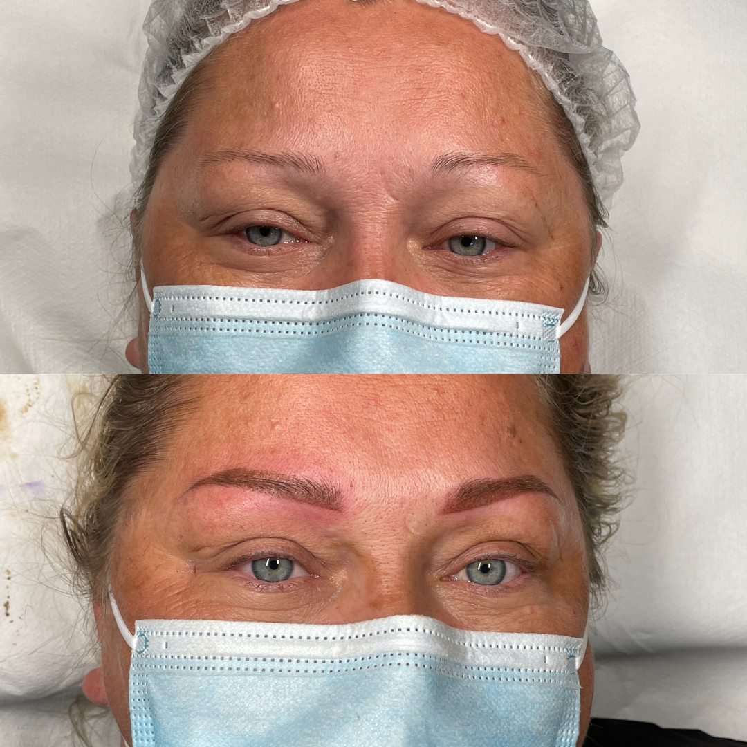 Close image of the result of a micropigmentation work by Deluxe Micropigmentation