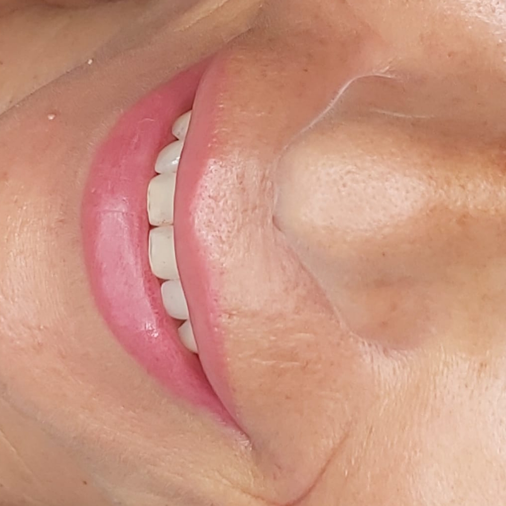 Close image of the result of a micropigmentation work by Deluxe Micropigmentation